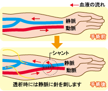 アンサー2イメージ